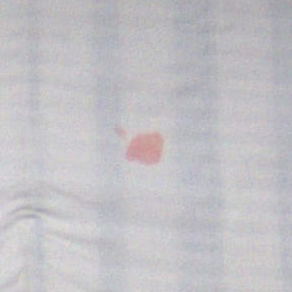 Red stain